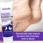 Cracked & Crusty Healthy Foot Cream - Image 2