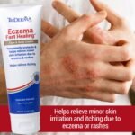 Eczema Cream for Face & Body, Itch Relief for Dry Sensitive Skin, Steroid-Free Moisturizer with Colloidal Oatmeal & Aloe, Helps Support Skin Barrier, Dermatologist Tested, 4.2 oz - Image 2