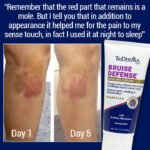 Bruise Defense Healing Cream For Those Who Bruise Easily - Image 2